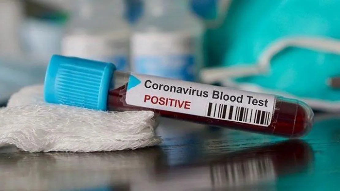 'Corona virüsü Türkiye'de' yalanı yayıldı Emniyet harekete geçti!