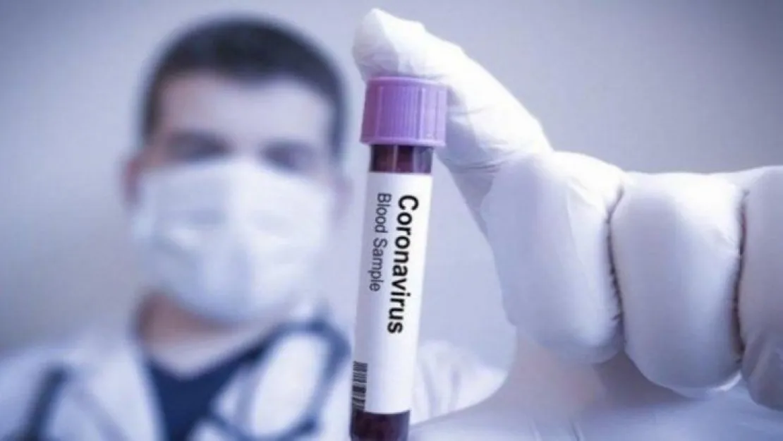 Coronavirüs için büyük umut!
