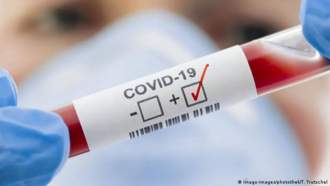 COVID-19 Genelgesi yürürlükten kaldırıldı