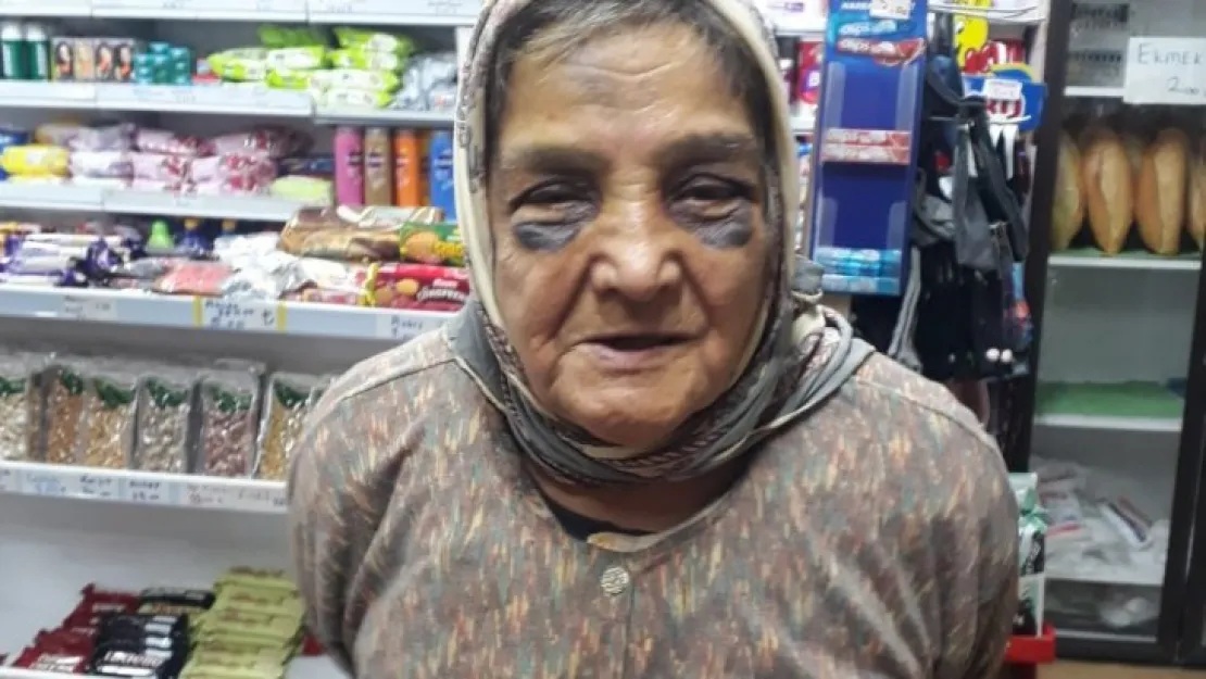 Demir çubukla 73 yaşındaki eşini döven adam hakkında yasal işlem başlatıldı
