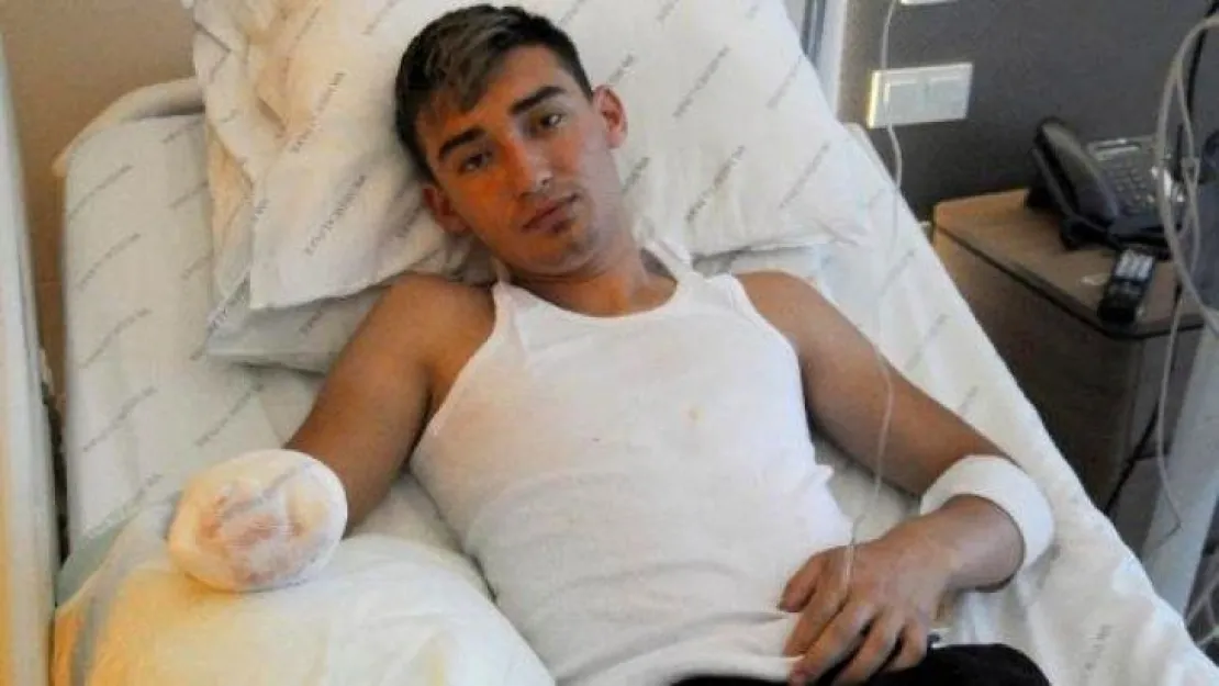 Elini kıyma makinesine kaptıran genç, protez el istiyor
