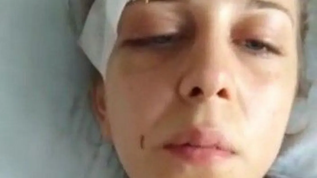 Eski eşinden saatler boyunca gördüğü işkenceyi böyle anlattı