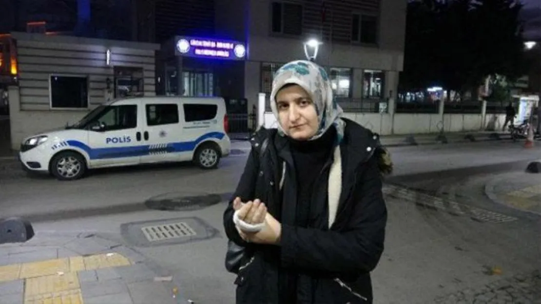 Gölcük'teki olayda eşinin elinde sigara söndürdü!