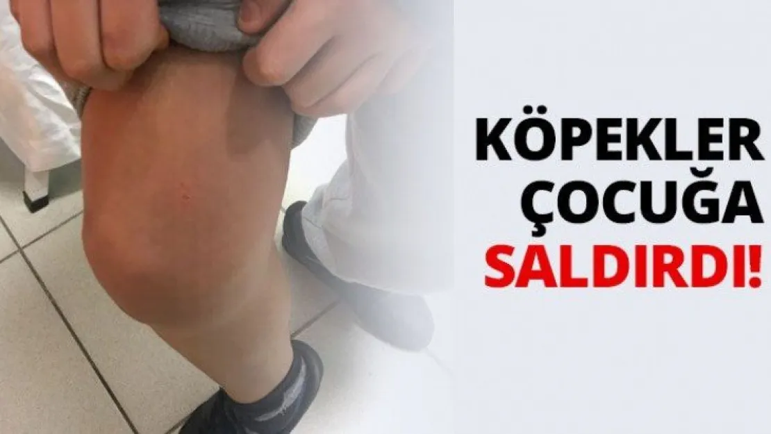 Köpekler çocuğa saldırdı!
