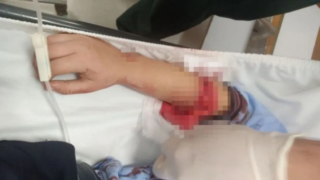Okulun ihmali yüzünden çocuk yaralandı