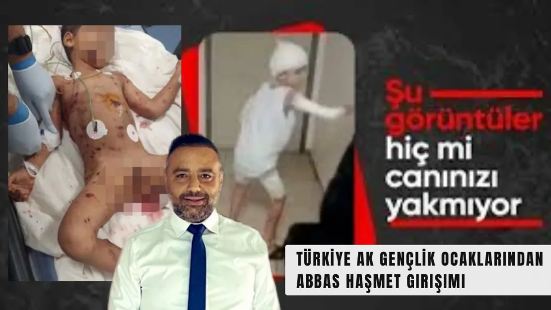 Türkiye'de başıboş köpek sorunu: Küçük Abbas Haşmet yoğun bakımda