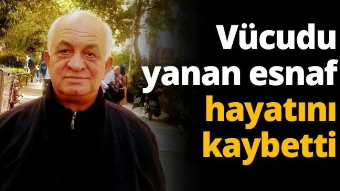 Vücudu yanan esnaf hayatını kaybetti