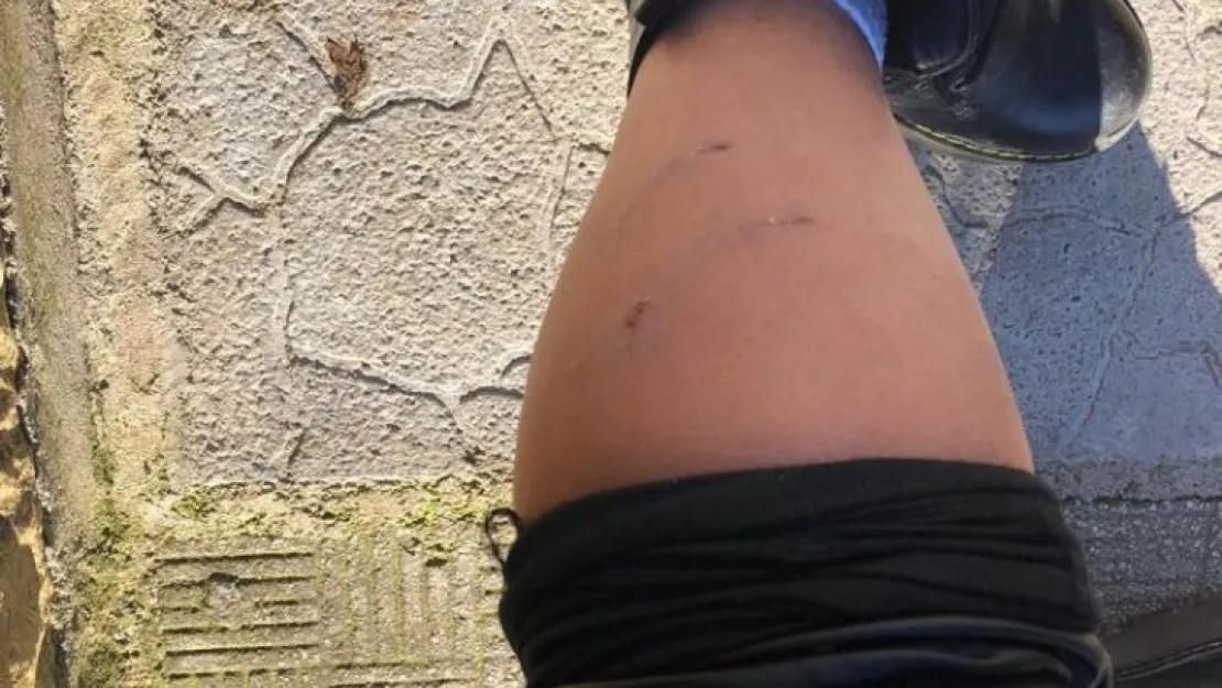 Yolda giderken köpeklerin saldırısına uğradı!