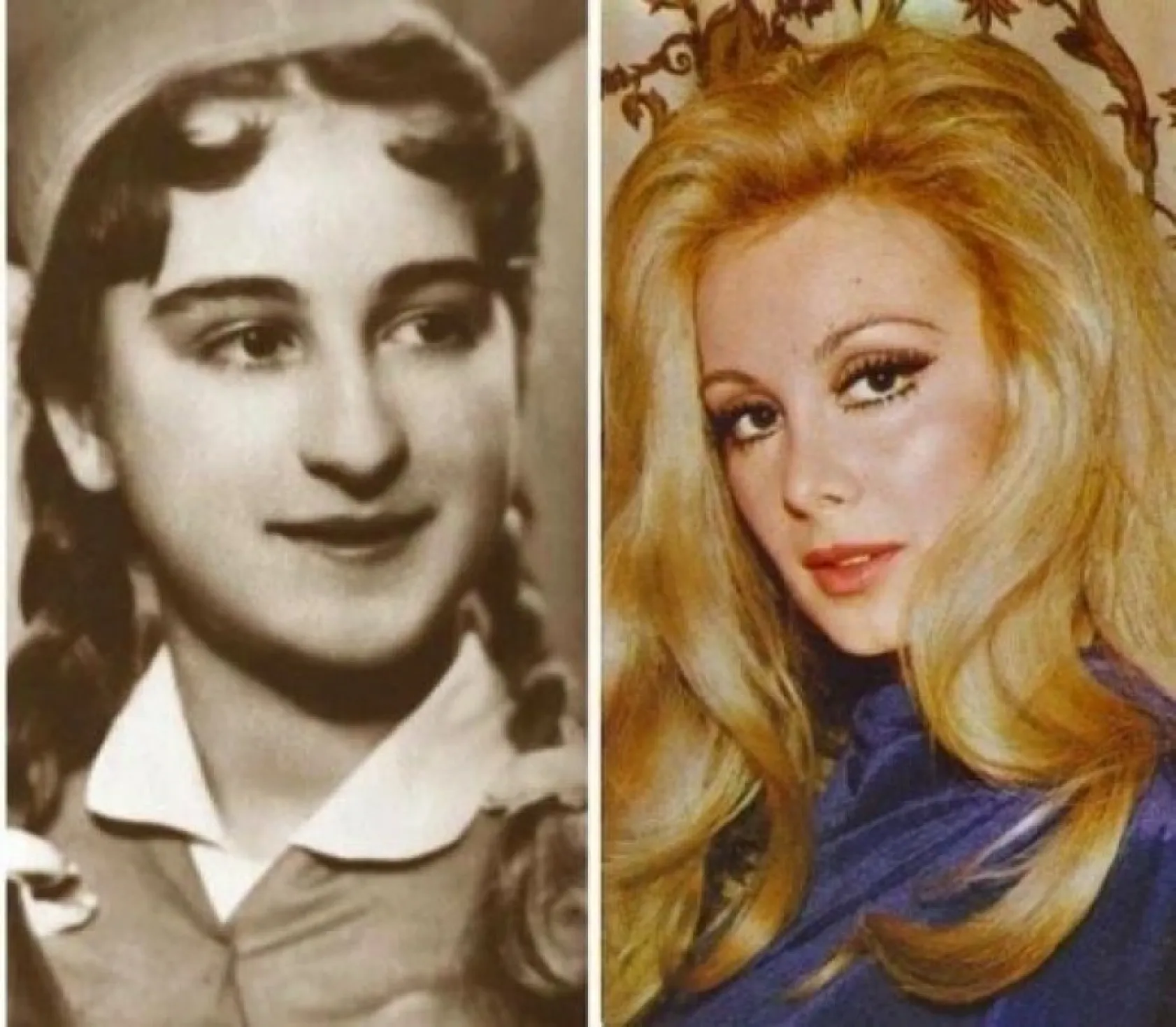 Ünlülerin şaşırtan değişimi