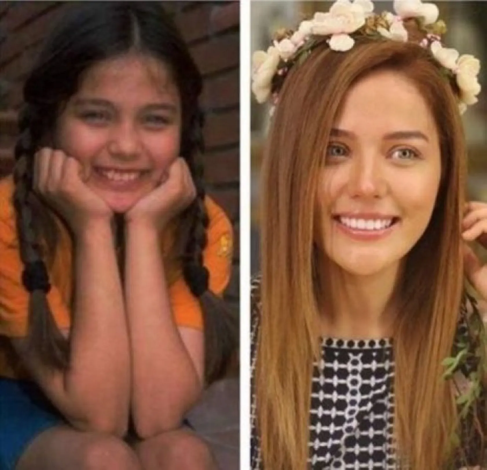 Ünlülerin şaşırtan değişimi