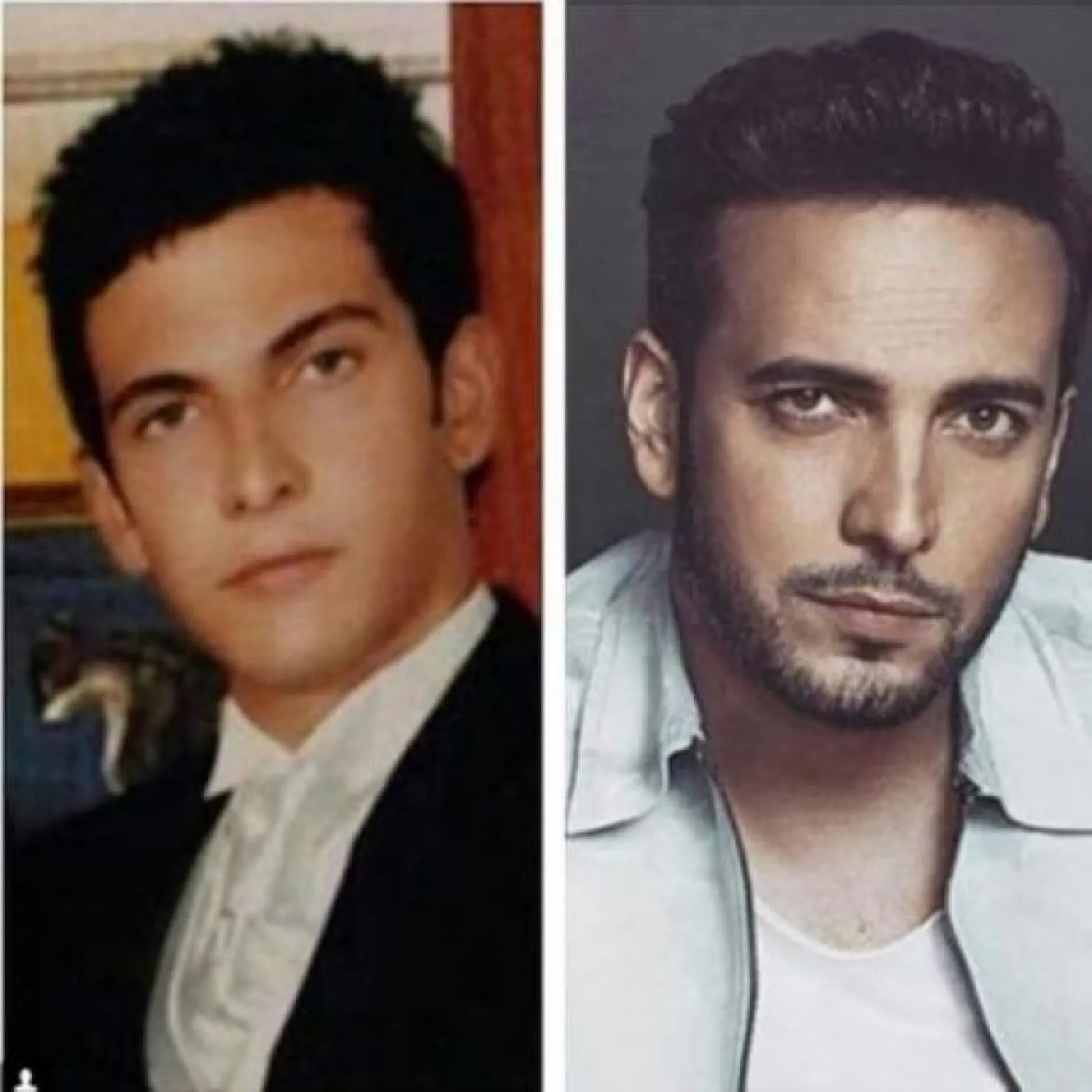 Ünlülerin şaşırtan değişimi