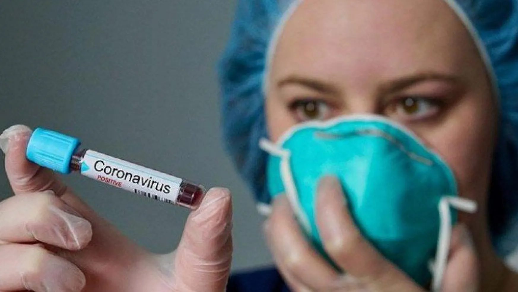Doktorlar koronavirüsün yeni belirtisini açıkladı
