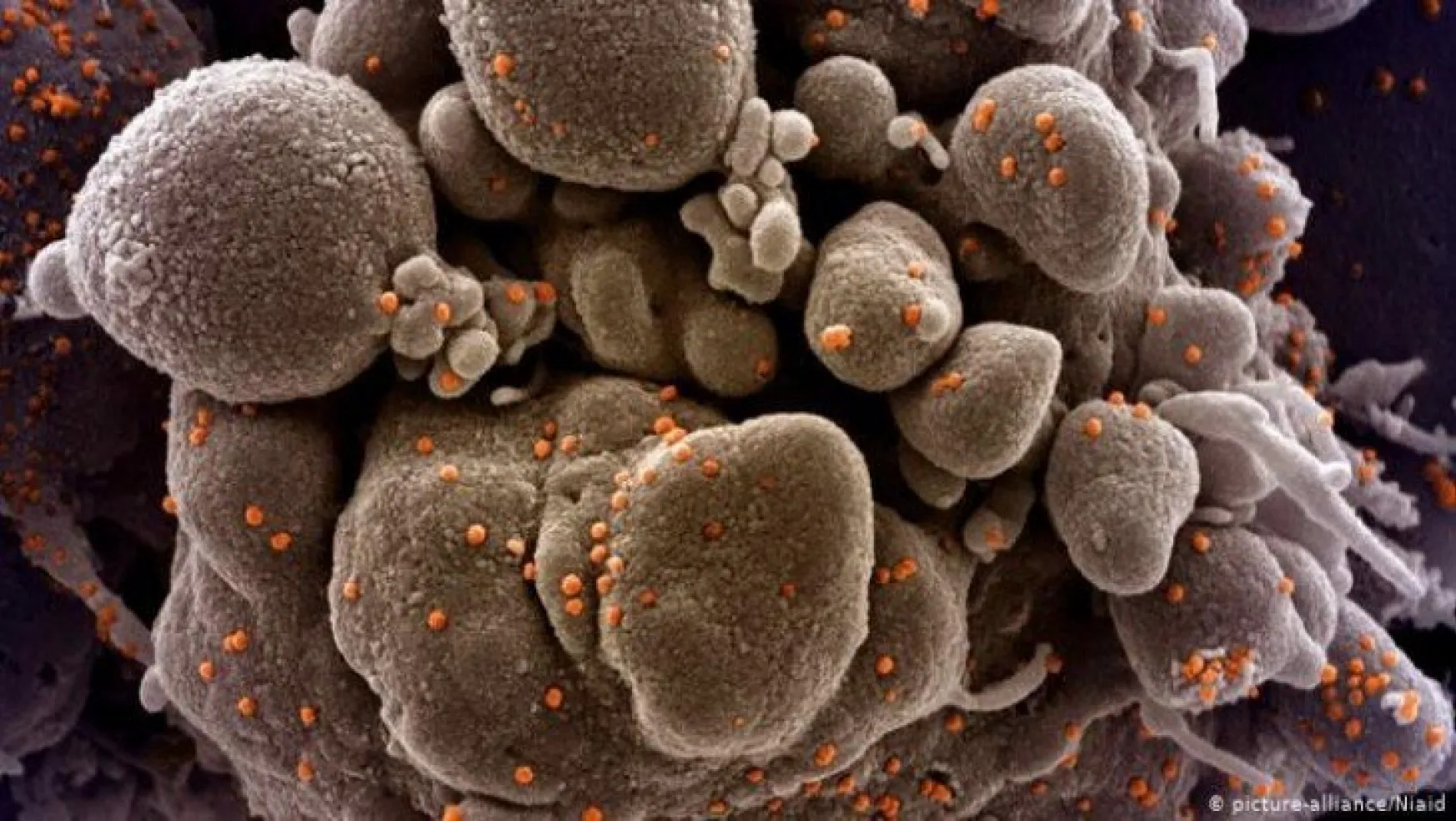 Mutasyonlu koronavirüsün ilk fotoğrafı yayınlandı!
