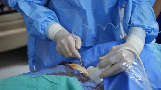 İğneyle tümör tedavisine uluslararası ilgi: Canlı canlı izlediler