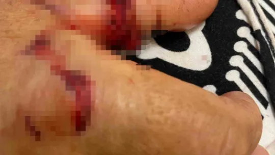 Abdest almak için bahçeye çıkan kadına köpekler saldırdı