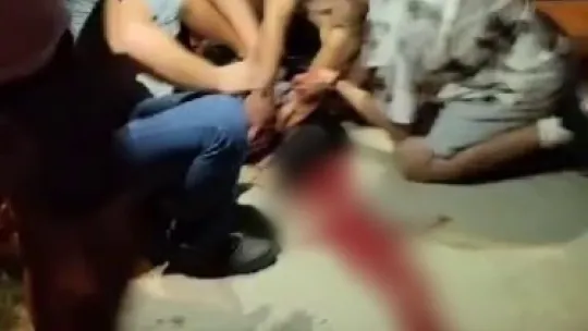 Sapanca'da alacak verecek meselesinde kan aktı