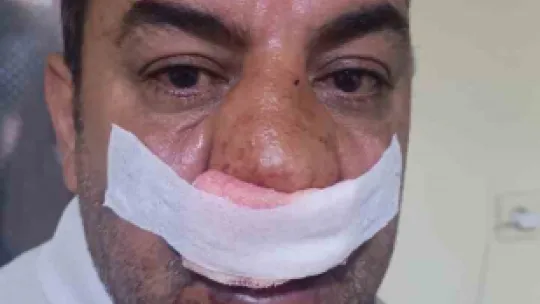 Arap turistten 4 fotoğraf için 2 bin 400 TL istediler, şoför karşı çıkınca burnunu kırdılar