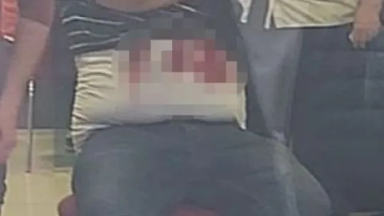 Bankada 2 müşteri arasında bıçaklı kavga: 1 yaralı