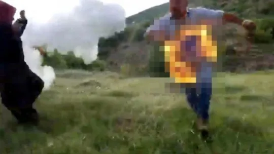 Cezaevine gitmemek için kendini ateşe verdi