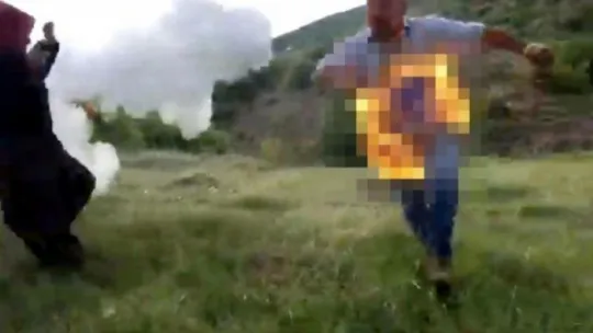 Cezaevine gitmemek için kendini ateşe verdi