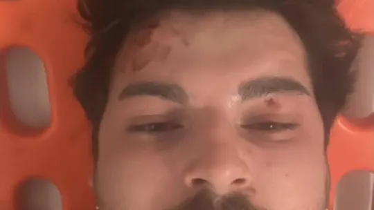 Darp edilen oyuncu dehşet anlarını anlattı