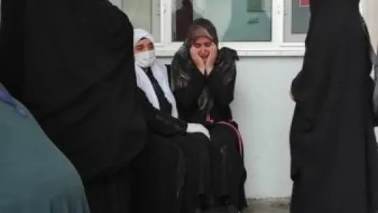 Ekmek tandırına düşüp yanan kadının kolu kesildi!
