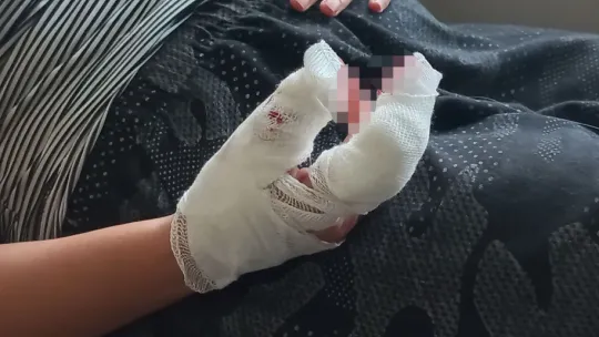 Eşini feci şekilde darp edip, bıçakla parmağını kesmeye çalıştı