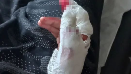 Eşini feci şekilde darp edip, bıçakla parmağını kesmeye çalıştı