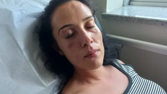 Eşini feci şekilde darp edip, bıçakla parmağını kesmeye çalıştı