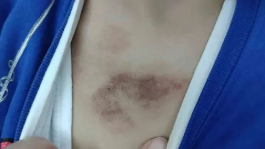 Kreşte istismar ve darp iddiası: Çocukları tacize uğrayan aile şikayetçi oldu