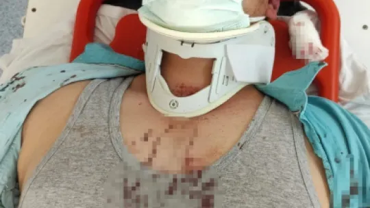 İHA muhabirini darp eden Türkkan'ın adamlarının tanığından komedi gibi savunma