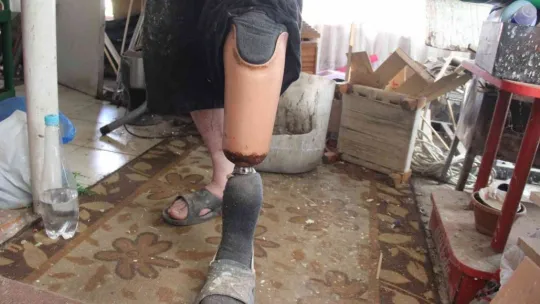 İki kolu ve bir bacağı olmayan adam yaptıklarıyla hayrete düşürüyor