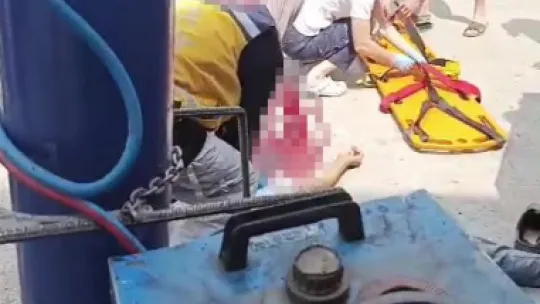 Kaynak sırasında kafası ezilen şoför feci şekilde can verdi
