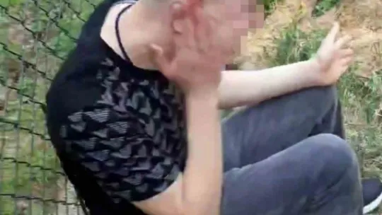 Kaza yaptı, ardından kendini tokatlayıp yumruklamaya başladı