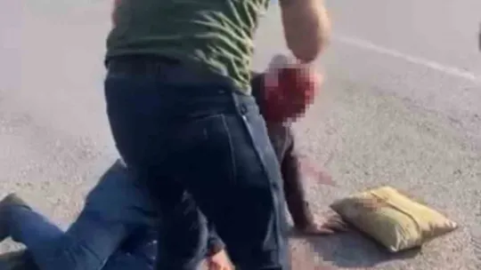 Kocaeli'de otomobil yayalara çarpıp refüje çıktı: 1'i ağır 2 yaralı