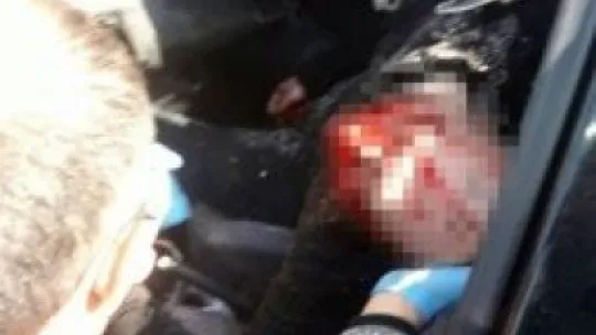 Kocaeli'de iki otomobil tır ile çarpıştı: 1 ölü, 3 yaralı