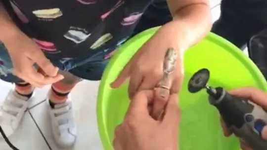Küçük çocuğun parmağında sıkışan yüzüğü itfaiye ekipleri çıkarabildi