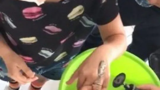 Küçük çocuğun parmağında sıkışan yüzüğü itfaiye ekipleri çıkarabildi