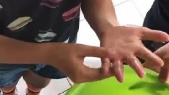 Küçük çocuğun parmağında sıkışan yüzüğü itfaiye ekipleri çıkarabildi