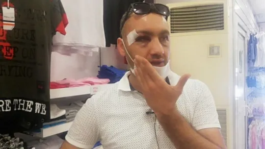 Maske takmayı kabul etmeyen şahıslar iş yeri sahibini böyle darp etti