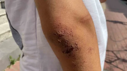Öldüresiye darp edilmişti, yaşadıklarını anlattı