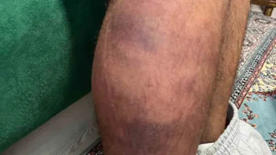 Otizmli adamı öldüresiye darp eden sanık ilk kez konuştu