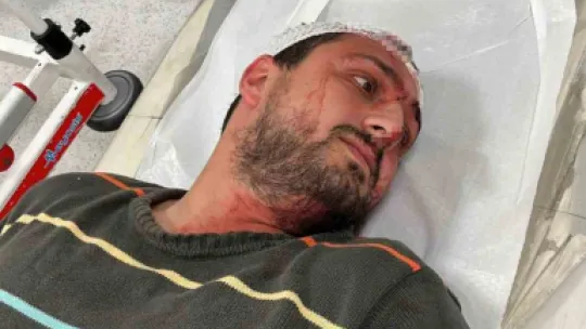 Otizmli adamı öldüresiye darp eden sanık ilk kez konuştu