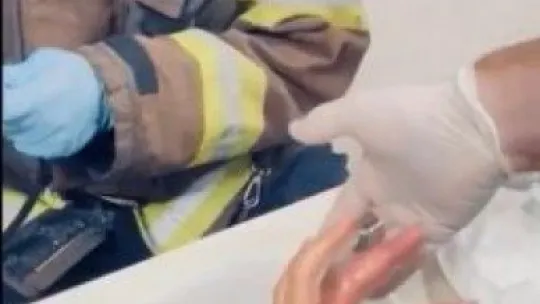 Parmağına sıkışan yüzüğü bakın nasıl çıkarttılar!