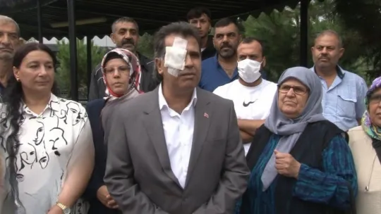 Görme kaybı oluştu, yine de şikayetçi olmadı