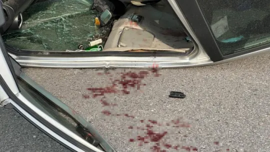 Sakarya'da ciple çarpışan otomobil takla attı: 1 yaralı