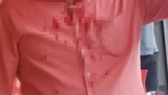 Şehrin göbeğinde falçatalı dehşet