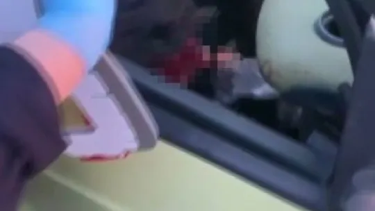 Seyir halindeki tıra çarpan Smart marka otomobilin sürücüsü sıkıştı