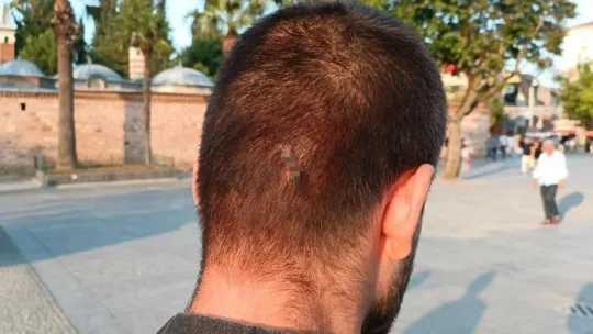 Kurye sokak ortasında dehşeti yaşadı