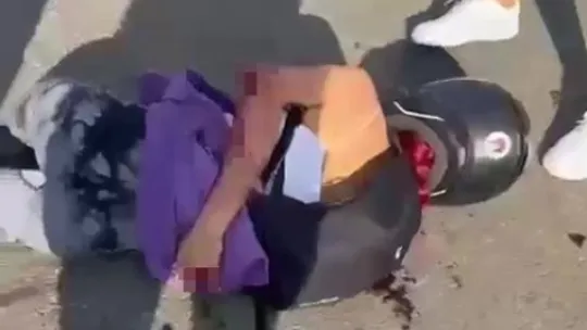 Sürat motoruyla hız faciayla bitti, metrelerce sürüklenen kızın kolu kopma noktasına geldi
